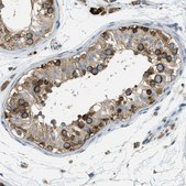 Anti-ABCF1 antibody produced in rabbit Prestige Antibodies® Powered by Atlas Antibodies, affinity isolated antibody, buffered aqueous glycerol solution