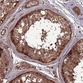 Anti-ATP6V0A2 antibody produced in rabbit Prestige Antibodies® Powered by Atlas Antibodies, affinity isolated antibody, buffered aqueous glycerol solution