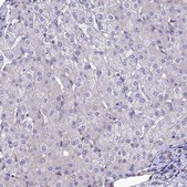 Anti-PPFIA3 antibody produced in rabbit Prestige Antibodies® Powered by Atlas Antibodies, affinity isolated antibody, buffered aqueous glycerol solution