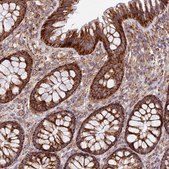 Anti-MRPL20 antibody produced in rabbit Prestige Antibodies® Powered by Atlas Antibodies, affinity isolated antibody, buffered aqueous glycerol solution