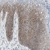 Anti-RPS12 antibody produced in rabbit Prestige Antibodies® Powered by Atlas Antibodies, affinity isolated antibody, buffered aqueous glycerol solution