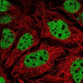 Anti-GPS2 antibody produced in rabbit Prestige Antibodies® Powered by Atlas Antibodies, affinity isolated antibody