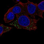 Anti-HBB antibody produced in rabbit Prestige Antibodies® Powered by Atlas Antibodies, affinity isolated antibody, buffered aqueous glycerol solution