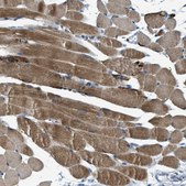 Anti-SLC25A11 antibody produced in rabbit Prestige Antibodies® Powered by Atlas Antibodies, affinity isolated antibody, buffered aqueous glycerol solution