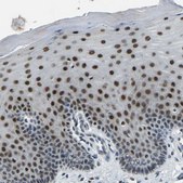 Anti-FOS antibody produced in rabbit Prestige Antibodies® Powered by Atlas Antibodies, affinity isolated antibody, buffered aqueous glycerol solution