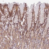 Anti-CHD9 antibody produced in rabbit Prestige Antibodies® Powered by Atlas Antibodies, affinity isolated antibody, buffered aqueous glycerol solution