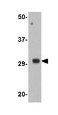 Anti-TREX1 Antibody from rabbit, purified by affinity chromatography