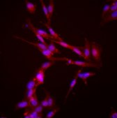 N27-A Rat Dopaminergic Neural Cell Line N27-A rat dopaminergic neural cell line is a suitable model for Parkinson’s disease research.