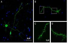 Milli-Mark® FluoroPanニューロンマーカー - Alexa488標識済み Milli-Mark FluoroPan Neuronal Marker -Alexa488 conjugated is an antibody targeting the FluoroPan Neuronal Marker protein, validated for use in ICC &amp; IF.