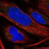 Anti-RAB11FIP2 antibody produced in rabbit Prestige Antibodies® Powered by Atlas Antibodies, affinity isolated antibody, buffered aqueous glycerol solution