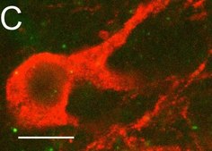 Anti-CAR Antibody, clone RmcB clone RmcB, Upstate®, from mouse