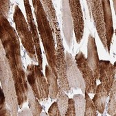Anti-PYGM antibody produced in rabbit Prestige Antibodies® Powered by Atlas Antibodies, affinity isolated antibody, buffered aqueous glycerol solution