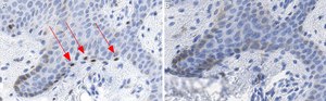 Anti-MITF Antibody, clone 1E2 ZooMAb® Rabbit Monoclonal recombinant, expressed in HEK 293 cells
