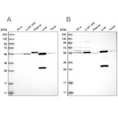 Anti-ALDH6A1 antibody produced in rabbit Prestige Antibodies® Powered by Atlas Antibodies, affinity isolated antibody, buffered aqueous glycerol solution, ab4