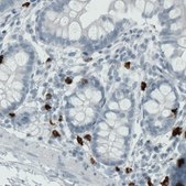 Monoclonal Anti-MMP9 antibody produced in mouse Prestige Antibodies® Powered by Atlas Antibodies, clone CL0538, purified immunoglobulin, buffered aqueous glycerol solution