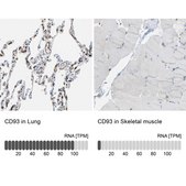 Anti-CD93 antibody produced in rabbit Prestige Antibodies® Powered by Atlas Antibodies, affinity isolated antibody, buffered aqueous glycerol solution