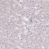 Anti-RAB9B antibody produced in rabbit Prestige Antibodies® Powered by Atlas Antibodies, affinity isolated antibody, buffered aqueous glycerol solution