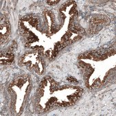 Anti-LZTR1 antibody produced in rabbit Prestige Antibodies® Powered by Atlas Antibodies, affinity isolated antibody, buffered aqueous glycerol solution