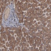 Anti-BNIP3 antibody produced in rabbit Prestige Antibodies® Powered by Atlas Antibodies, affinity isolated antibody, buffered aqueous glycerol solution