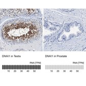 Anti-DNAI1 antibody produced in rabbit Prestige Antibodies® Powered by Atlas Antibodies, affinity isolated antibody, buffered aqueous glycerol solution, Ab1