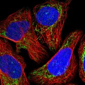 Anti-NDUFB11 antibody produced in rabbit Prestige Antibodies® Powered by Atlas Antibodies, affinity isolated antibody, buffered aqueous glycerol solution