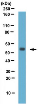 Anti-RGS11 (CT) Antibody from rabbit