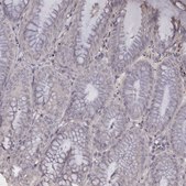 Anti-TNNI1 antibody produced in rabbit Prestige Antibodies® Powered by Atlas Antibodies, affinity isolated antibody, buffered aqueous glycerol solution