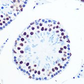 Anti-PN1 antibody produced in rabbit