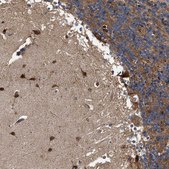 Anti-GUCY1B3 antibody produced in rabbit Prestige Antibodies® Powered by Atlas Antibodies, affinity isolated antibody, buffered aqueous glycerol solution