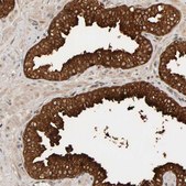 Anti-PPP1R16A antibody produced in rabbit Prestige Antibodies® Powered by Atlas Antibodies, affinity isolated antibody, buffered aqueous glycerol solution, Ab2