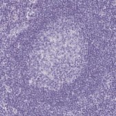 Anti-KRT10 antibody produced in rabbit Prestige Antibodies® Powered by Atlas Antibodies, affinity isolated antibody, buffered aqueous glycerol solution