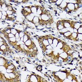 Anti-p70 S6 Kinase 2 antibody produced in rabbit