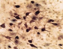 Anti-Choline Acetyltransferase Antibody serum, Chemicon®