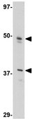 Anti-FEZ2 Antibody from rabbit, purified by affinity chromatography