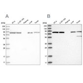 Anti-IMMT antibody produced in rabbit Prestige Antibodies® Powered by Atlas Antibodies, affinity isolated antibody, buffered aqueous glycerol solution
