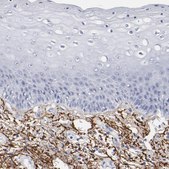 Anti-EMILIN1 antibody produced in rabbit Prestige Antibodies® Powered by Atlas Antibodies, affinity isolated antibody, buffered aqueous glycerol solution