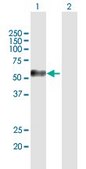 Anti-MAGEC2 antibody produced in mouse purified immunoglobulin, buffered aqueous solution