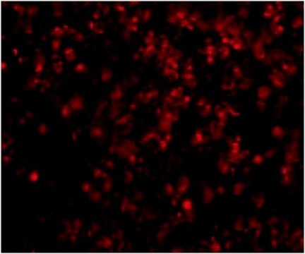 Anti-LIPE Antibody from rabbit, purified by affinity chromatography