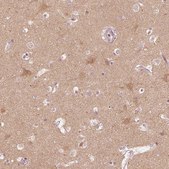 Anti-KIF5C antibody produced in rabbit Prestige Antibodies® Powered by Atlas Antibodies, affinity isolated antibody, buffered aqueous glycerol solution