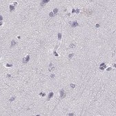 Anti-HIST1H1T antibody produced in rabbit Prestige Antibodies® Powered by Atlas Antibodies, affinity isolated antibody