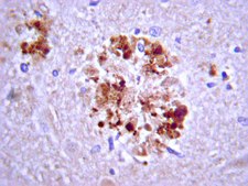 Anti-APP A4 Antibody, a.a. 66-81 of APP (NT) antibody produced in mouse clone 22C11