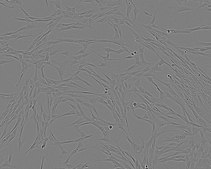 IMR-90 Cell Line human NOTE: Both the cell line and DNA from the cell line may be available for this product. Please choose -1VL or VIAL for cells, or -DNA-5UG for DNA, 85020204, human lung (fetal), Fibroblast