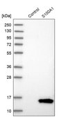 Anti-S100A1 antibody produced in rabbit Prestige Antibodies® Powered by Atlas Antibodies, affinity isolated antibody, buffered aqueous glycerol solution