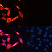 Anti-P70 S6K antibody produced in rabbit