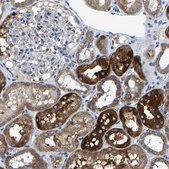 Anti-AGK antibody produced in rabbit Prestige Antibodies® Powered by Atlas Antibodies, affinity isolated antibody, buffered aqueous glycerol solution