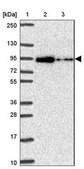 Anti-ALDH16A1 antibody produced in rabbit Prestige Antibodies® Powered by Atlas Antibodies, affinity isolated antibody, buffered aqueous glycerol solution