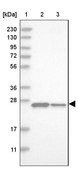 Anti-DCTN6 antibody produced in rabbit Prestige Antibodies® Powered by Atlas Antibodies, affinity isolated antibody, buffered aqueous glycerol solution, Ab2