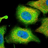 Anti-PLA2G4A antibody produced in rabbit Prestige Antibodies® Powered by Atlas Antibodies, affinity isolated antibody, buffered aqueous glycerol solution