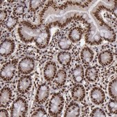 Anti-SP1 antibody produced in rabbit Ab1, Prestige Antibodies® Powered by Atlas Antibodies, affinity isolated antibody, buffered aqueous glycerol solution
