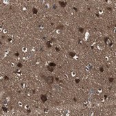Anti-HPRT1 antibody produced in rabbit Prestige Antibodies® Powered by Atlas Antibodies, affinity isolated antibody, buffered aqueous glycerol solution